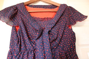 spots before your eyes